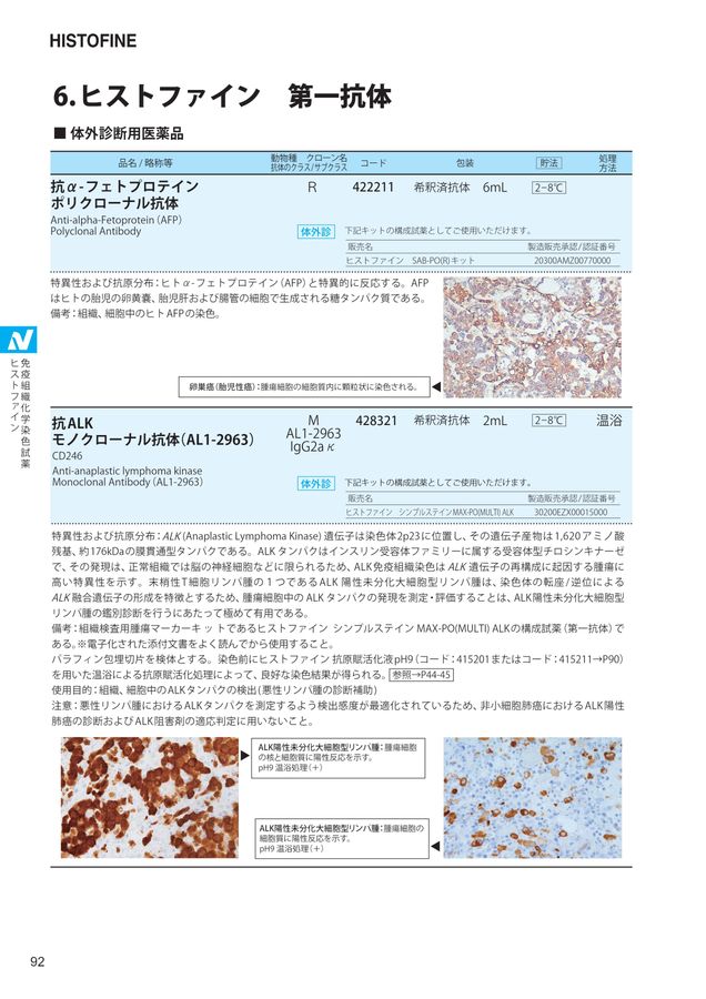 【古本】モノクローナル抗体とがん―基礎と臨床 (1985年) 古本】モノクローナル抗体とがん―基礎と臨床 (1985年) 古本